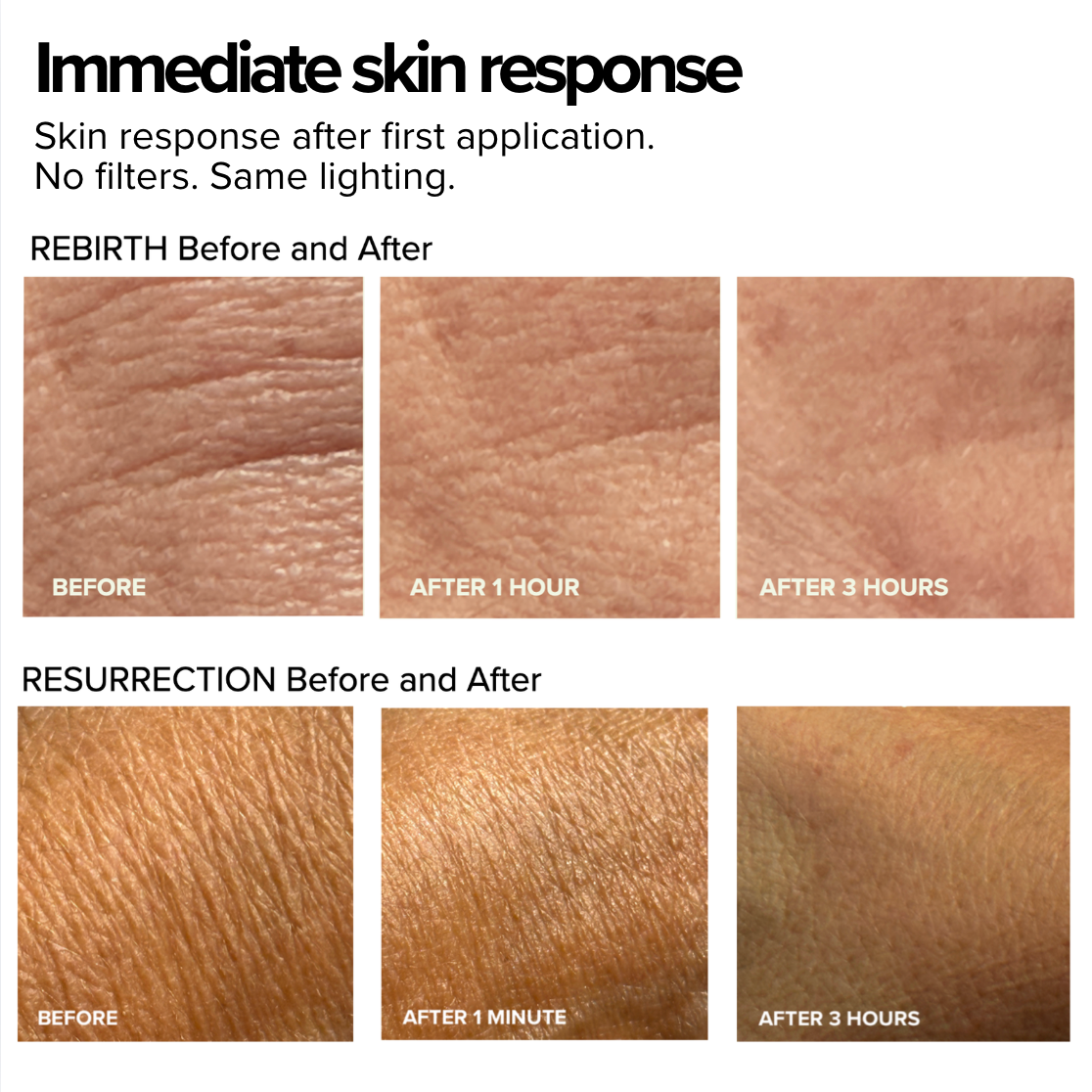 Before and after skin response comparison for 'Rebirth' and 'Resurrection' products on a white background.
